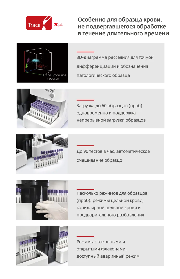 Dymind DH-76 — Трёхмерная скатерограмма дифференцировки