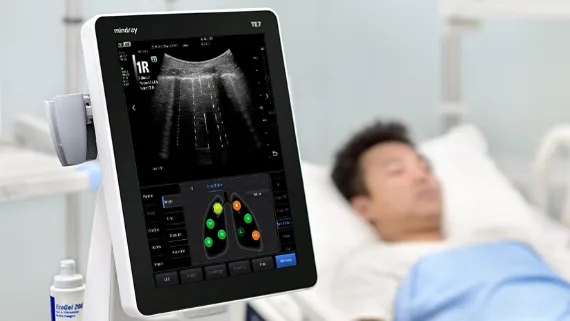 Mindray TE7 — Smart B-line — жидкость в лёгких