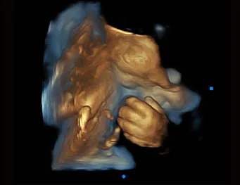 CHISON QBit 9 — Акушерство и 4D: Virtual HD и Depth View — фото 4