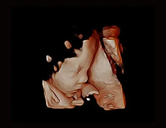 CHISON QBit 7 — Акушерство и 4D: Virtual HD и Depth View — фото 3