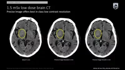 Philips Incisive CT — Клинические изображения — фото 3