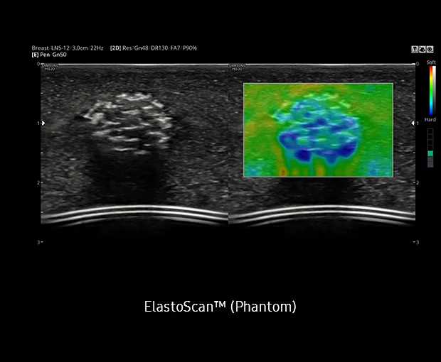 Samsung HS30 — ElastoScan: жёсткость тканей в цвете