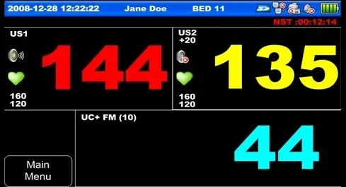 Bionet FC1400 — Два режима экрана: график и крупные числа