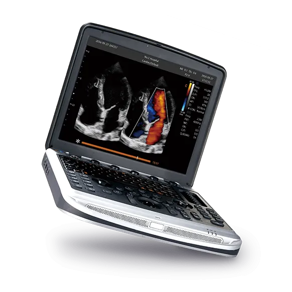 CHISON SonoBook 8