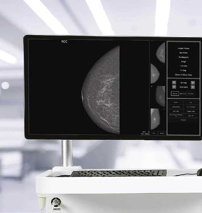 Genoray DMX-600 — Рабочая станция с программой SMARTMAM