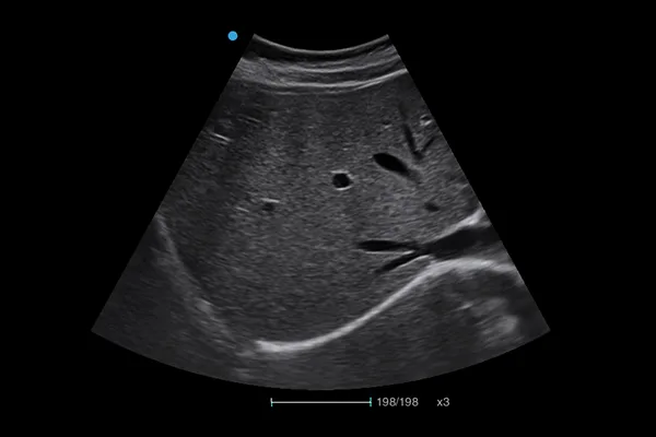 SIUI Apogee 3500 — Клинические изображения — фото 1