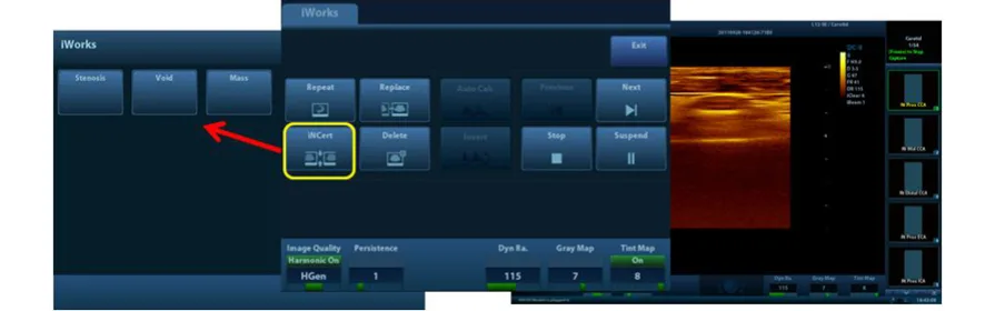 Mindray M9 — iStation, iTouch, iWorks: рабочий процесс