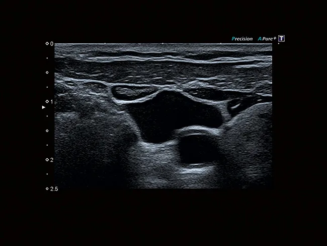 Canon Xario 200G — Precision Imaging и ApliPure+
