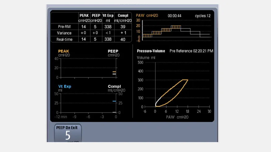 Mindray WATO EX-65 Pro — Манёвр рекрутмента лёгких