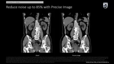 Philips Incisive CT — Клинические изображения — фото 5